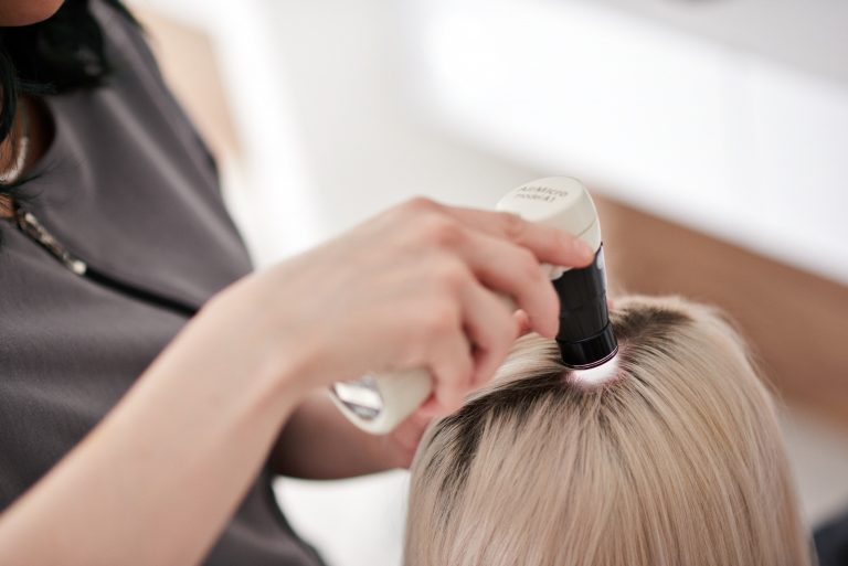 « J’ai des boutons au cuir chevelu, quelle pourrait être la cause? »