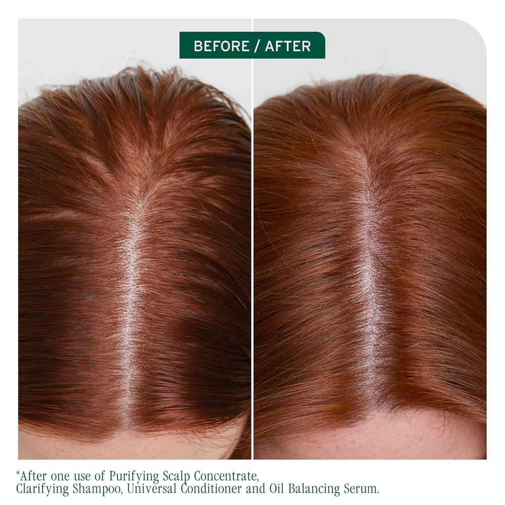 Flacon de 400 ml du Biolage Scalp Sync Clarifying Shampoo, shampooing clarifiant pour cuir chevelu gras, enrichi en thé fermenté et acide glycolique.