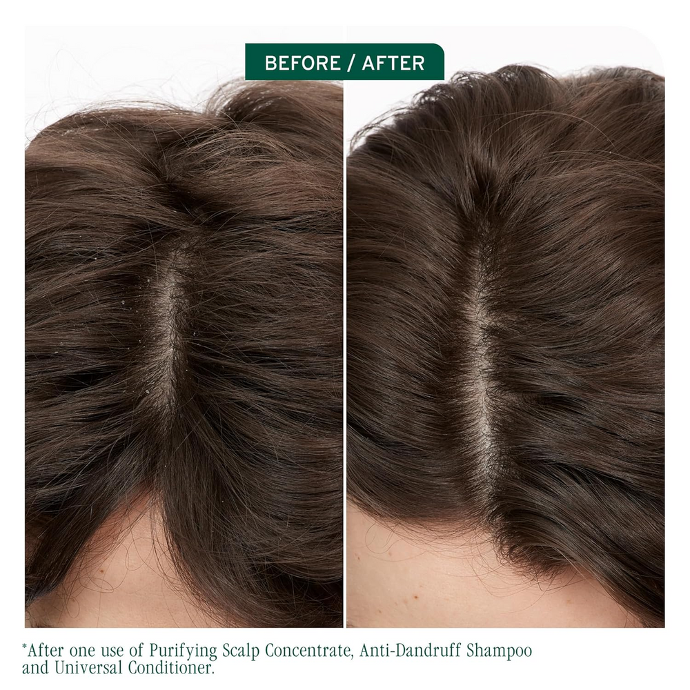 Flacon du Purifying Scalp Concentrate Biolage Scalp Sync, traitement exfoliant pré‑shampooing au thé fermenté et acide glycolique, pour cuir chevelu clarifié et rafraîchi.