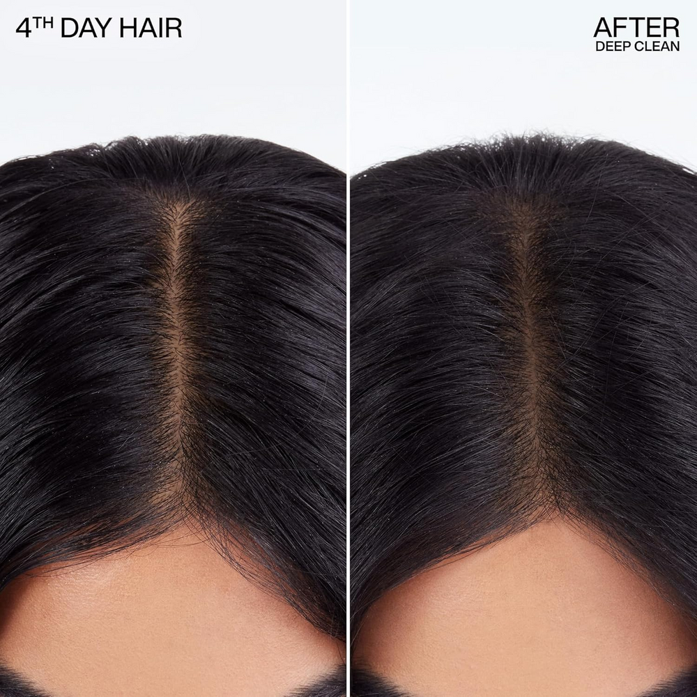 Aérosol de Redken Deep Clean Dry Shampoo, spray sec absorbant pour cheveux propres et frais jusqu’à 4 jours