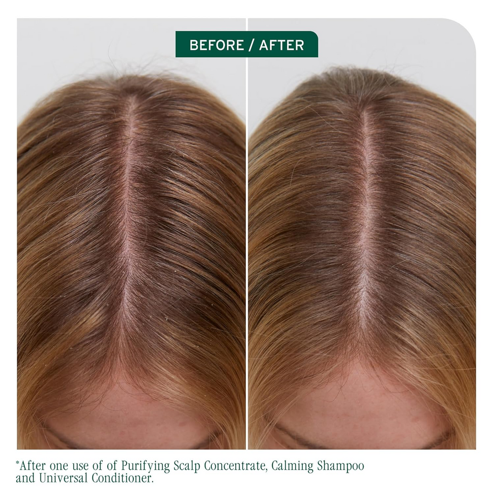 Flacon du shampooing Biolage Scalp Sync Calming – soin apaisant pour cuir chevelu irrité, sans silicone ni parabènes, formule douce vegan.