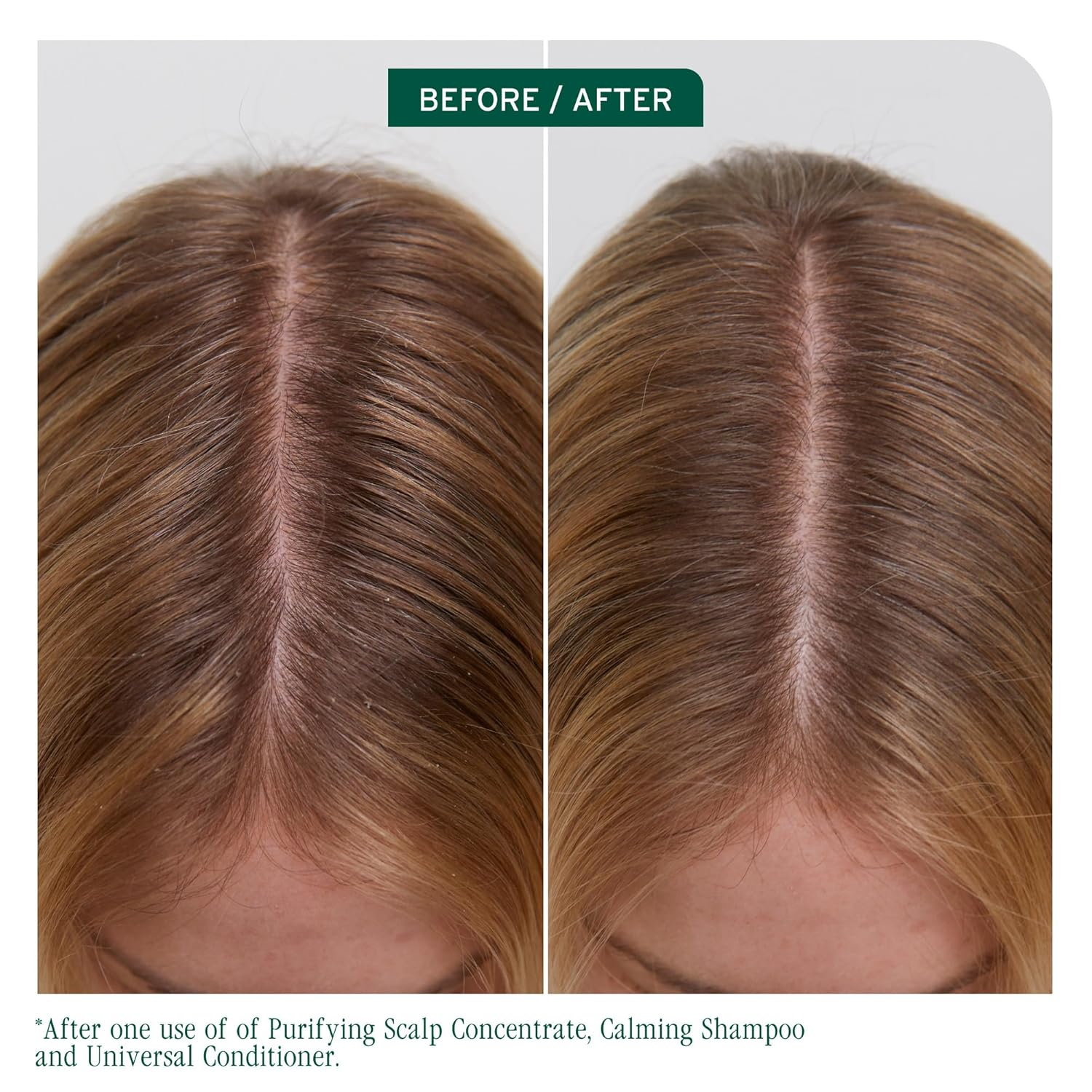 “Conditionneur Universel Biolage Scalp Sync 236 ml — flacon blanc/vert, hydratation légère pour tous les types de cuir chevelu”