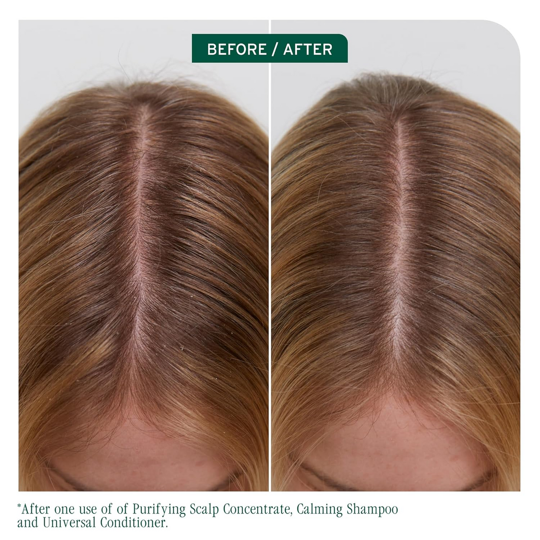 Flacon du Purifying Scalp Concentrate Biolage Scalp Sync, traitement exfoliant pré‑shampooing au thé fermenté et acide glycolique, pour cuir chevelu clarifié et rafraîchi.