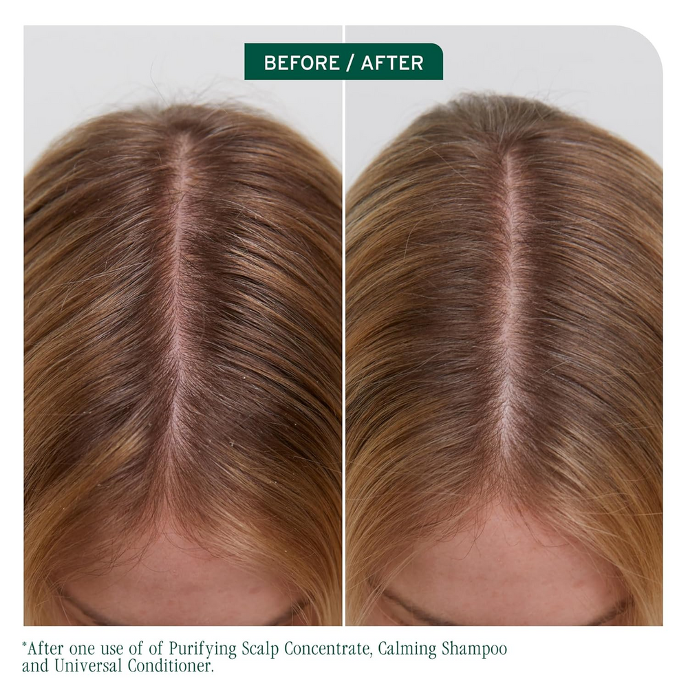 Flacon du Purifying Scalp Concentrate Biolage Scalp Sync, traitement exfoliant pré‑shampooing au thé fermenté et acide glycolique, pour cuir chevelu clarifié et rafraîchi.