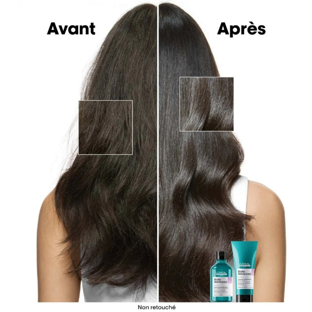 Flacon du Shampoing Dermo-Régulateur Anti-Inconfort Scalp Advanced 500 ml de L'Oréal Professionnel, soin apaisant pour cuir chevelu sensible.