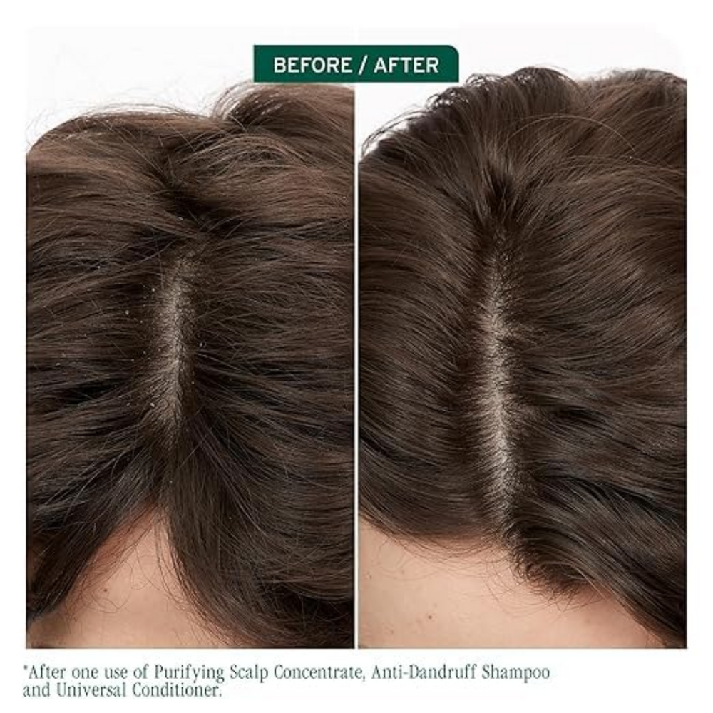 Flacon de 400 ml du shampooing Biolage ScalpSync Anti-Dandruff, enrichi en pyrithione de zinc et extrait de menthe poivrée, pour un cuir chevelu apaisé.
